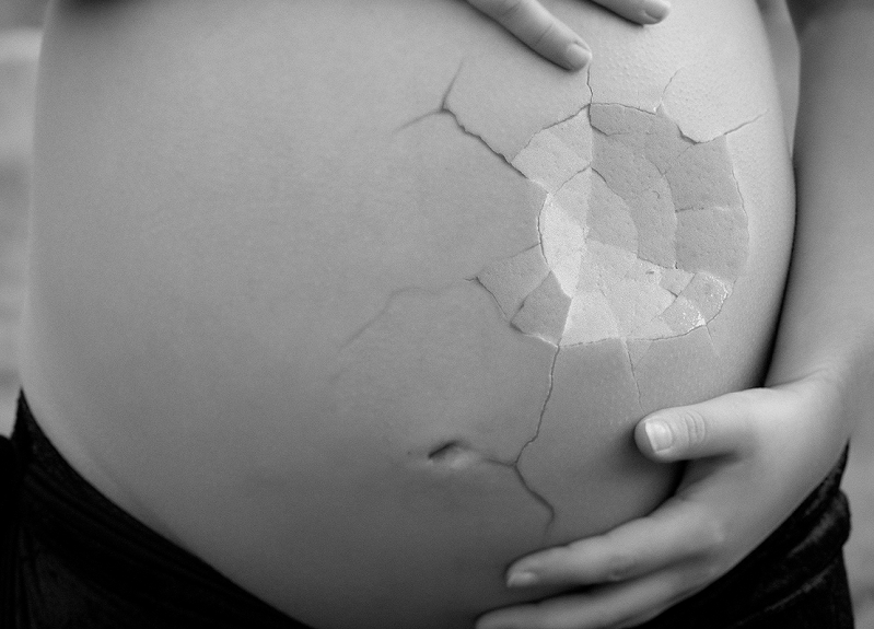 Boric Aborto