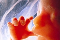 Feto, niño no nacido