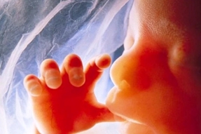 Feto, niño no nacido