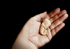 Alcalde brasileño impone nueva norma sobre el aborto en adolescentes y genera controversia legal