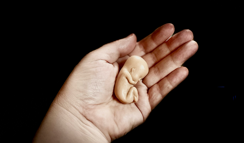 Alcalde brasileño impone nueva norma sobre el aborto en adolescentes y genera controversia legal
