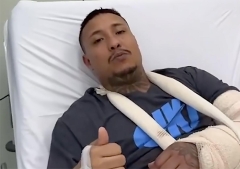 Cantante cristiano sobrevive a un disparo en la cabeza y conmueve a miles con su testimonio de fe