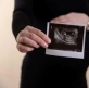 Cristianos en Países Bajos rechazan plan para expandir el aborto tardío por 